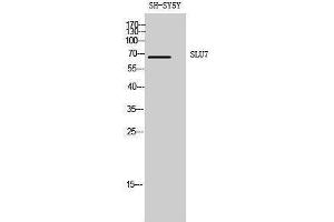Western Blotting (WB) image for anti-SLU7 Splicing Factor Homolog (SLU7) (Internal Region) antibody (ABIN3177435) (SLU7 抗体  (Internal Region))