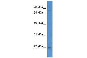 WB Suggested Anti-WIBG Antibody Titration: 0. (PYM 抗体  (C-Term))