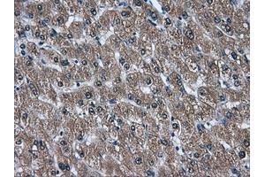 Immunohistochemical staining of paraffin-embedded liver tissue using anti-AKR1A1mouse monoclonal antibody. (AKR1A1 抗体)