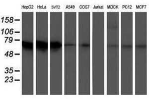 Image no. 2 for anti-5-Aminoimidazole-4-Carboxamide Ribonucleotide Formyltransferase/IMP Cyclohydrolase (ATIC) antibody (ABIN1496503) (ATIC 抗体)