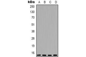 Western blot analysis of 4EBP1 expression in MCF7 (A), HEK293T (B), mouse brain (C), rat brain (D) whole cell lysates. (eIF4EBP1 抗体  (N-Term))