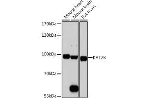 Western blot analysis of extracts of various cell lines, using KB antibody (ABIN1680550, ABIN3015032, ABIN3015033, ABIN5663568 and ABIN6213605) at 1:1000 dilution. (KAT2B 抗体  (AA 583-832))