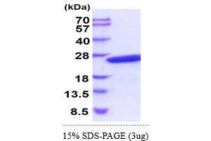 SDS-PAGE (SDS) image for Crystallin, gamma D (CRYGD) (AA 1-174) protein (His tag) (ABIN5854999) (CRYGD Protein (AA 1-174) (His tag))