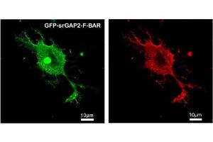 Immunofluorescence (IF) image for anti-SLIT-ROBO rho GTPase Activating Protein 2 (SRGAP2) antibody (ABIN5935194) (SRGAP2 抗体)