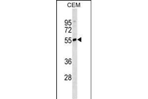 IGHD Antibody (N-term)(Ascites) ABIN1539994 western blot analysis in CEM cell line lysates (35 μg/lane). (IgD 抗体  (N-Term))