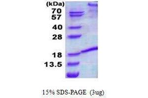 Figure annotation denotes ug of protein loaded and % gel used. (FASL 蛋白)