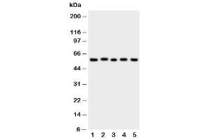Western blot testing of ASIC3 antibody and Lane 1:  rat brain (ASIC3 抗体  (N-Term))