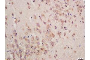 Formalin-fixed and paraffin embedded mouse brain labeled with Rabbit Anti-GSTA3 Polyclonal Antibody, Unconjugated (ABIN755767) at 1:200 followed by conjugation to the secondary antibody and DAB staining (GSTA3 抗体  (AA 131-222))