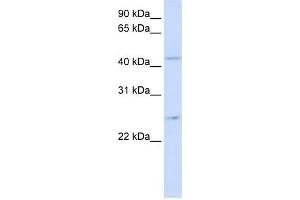 Western Blotting (WB) image for anti-Solute Carrier Family 37 (Glucose-6-Phosphate Transporter), Member 4 (SLC37A4) (N-Term) antibody (ABIN2781569)