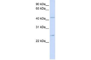 WB Suggested Anti-SLC37A4 Antibody Titration:  0. (SLC37A4 抗体  (N-Term))