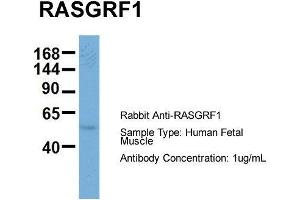 Western Blotting (WB) image for anti-Ras Protein-Specific Guanine Nucleotide-Releasing Factor 1 (RASGRF1) (Middle Region) antibody (ABIN2786746)