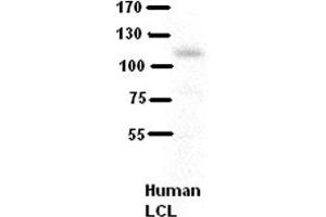Western Blotting (WB) image for anti-Collagen, Type VI, alpha 1 (COL6A1) (Middle Region) antibody (ABIN2782366)
