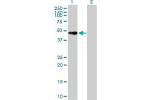 Western Blot analysis of VDR expression in transfected 293T cell line by VDR MaxPab polyclonal antibody. (Vitamin D Receptor 抗体  (AA 1-427))