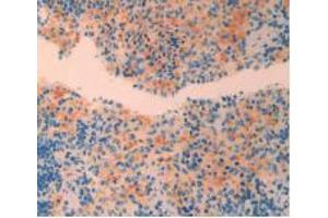 IHC-P analysis of Rat Spleen Tissue, with DAB staining. (CRH 抗体  (AA 39-187))