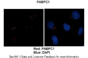 Sample Type :  Human brain stem cells (NT2)   Primary Antibody Dilution :   1:500  Secondary Antibody :  Goat anti-rabbit Alexa Fluor 594  Secondary Antibody Dilution :   1:1000  Color/Signal Descriptions :  Red: PABPC1 Blue: DAPI  Gene Name :  PABPC1  Submitted by :  Dr. (PABP 抗体  (Middle Region))