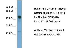WB Suggested Anti-DYX1C1  Antibody Titration: 0. (DYX1C1 抗体  (Middle Region))