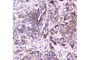 Immunohistochemistry (IHC) image for anti-Succinate Dehydrogenase Complex, Subunit B, Iron Sulfur (Ip) (SDHB) (AA 29-280) antibody (ABIN5693211)
