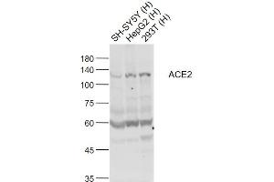 Lane 1: SH-SY5Y cell lysates; Lane 2: HepG2 cell lysates; Lane 3: 293T cell lysates probed with ACE2 Polyclonal Antibody, Unconjugated (bs-23443R) at 1:1000 dilution and 4˚C overnight incubation.