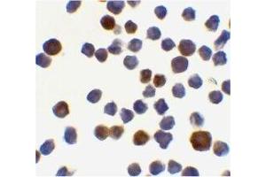Immunocytochemical staining of K562 cells using Acinus antibody at 0. (ACIN1 抗体  (C-Term))