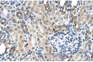 Immunohistochemistry (IHC) image for anti-Solute Carrier Family 19 (Folate Transporter), Member 1 (SLC19A1) (N-Term) antibody (ABIN2781749)