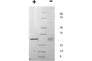 SDS-PAGE of Human Mouse Epstein-Barr Virus Induced Gene 3 Recombinant Protein SDS-PAGE of Mouse Epstein-Barr Virus Induced Gene 3 Recombinant Protein. (EBI3 蛋白)