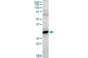 FAIM2 polyclonal antibody (A01), Lot # 051122JC01. (FAIM2 抗体  (AA 1-316))