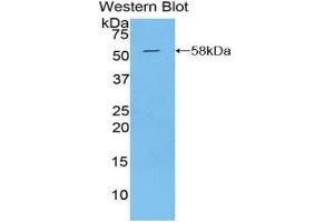 Western blot analysis of the recombinant protein. (Kallikrein 6 抗体  (AA 26-261))