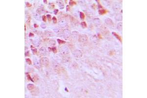 Immunohistochemical analysis of TRAF3IP1 staining in human brain formalin fixed paraffin embedded tissue section. (TRAF3IP1 抗体  (Center))