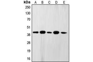 Western blot analysis of FEN1 expression in A431 (A), MCF7 (B), U937 (C), NIH3T3 (D), PC12 (E) whole cell lysates. (FEN1 抗体  (Center))
