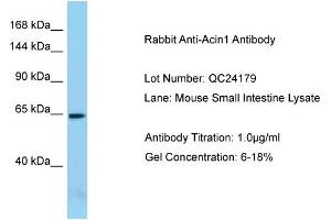 Host: Rabbit Target Name: Acin1 Sample Type: Mouse Small Intestine Antibody Dilution: 1. (ACIN1 抗体  (N-Term))
