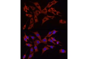 Immunofluorescence analysis of NIH/3T3 cells using S6 Ribosomal Protein (RPS6) Rabbit mAb (ABIN7270026) at dilution of 1:100 (40x lens). (RPS6 抗体)