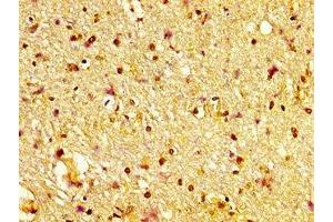 IHC image of ABIN7170335 diluted at 1:600 and staining in paraffin-embedded human brain tissue performed on a Leica BondTM system. (Sortilin 1 抗体  (AA 328-457))