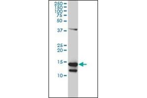 Western Blotting (WB) image for anti-CD247 Molecule (CD247) (AA 1-165) antibody (ABIN782349) (CD247 抗体  (AA 1-165))