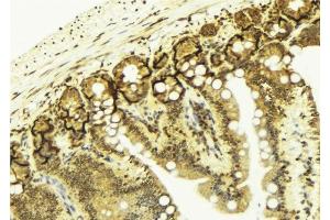 ABIN6276685 at 1/100 staining Mouse colon tissue by IHC-P. (Galectin 3 抗体  (Internal Region))