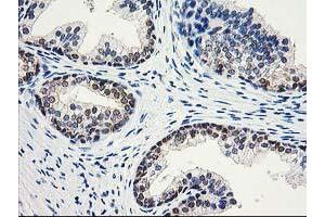 Image no. 7 for anti-Aminoacylase 1 (ACY1) antibody (ABIN1496454) (Aminoacylase 1 抗体)