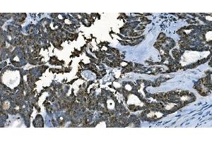 IHC analysis of CDC45L using anti-CDC45L antibody (ABIN7600230).