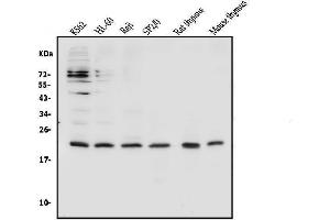 Western blot analysis of CD69 using anti-CD69 antibody (ABIN7599623). (CD69 抗体  (AA 101-148))