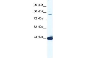 DDX55 antibody used at 1. (DDX55 抗体)