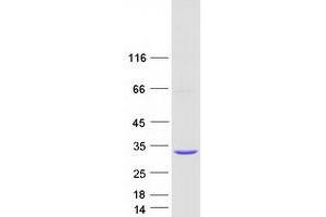 Western Blotting (WB) image for Potassium Channel Tetramerisation Domain Containing 6 (KCTD6) (Transcript Variant 2) protein (Myc-DYKDDDDK Tag) (ABIN2724081)