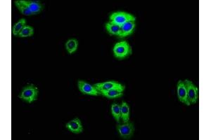 Immunofluorescence staining of HepG2 cells with ABIN7167891 at 1:100, counter-stained with DAPI. (RECK 抗体  (AA 23-212))