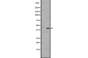 Western blot analysis of EBI2 expression in A431 whole cell lysate ,The lane on the left is treated with the antigen-specific peptide.