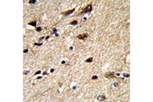 Immunohistochemistry (IHC) image for anti-Tubulin, beta 1 (TUBB1) antibody (ABIN3029794)