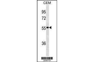 Image no. 1 for Mouse anti-Human IgA (AA 150-178) antibody (ABIN1480665) (小鼠 anti-人 IgA (AA 150-178) Antibody)