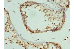 Immunohistochemistry of paraffin-embedded human testis tissue using ABIN7148180 at dilution of 1:100 (CCDC97 抗体  (AA 1-343))