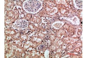 Immunohistochemical analysis of paraffin-embedded human-kidney, antibody was diluted at 1:200 (HMMR 抗体  (AA 280-340))