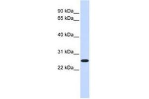 Image no. 1 for anti-CTD Nuclear Envelope Phosphatase 1a (CTDNEP1A) (C-Term) antibody (ABIN6740996) (CTDNEP1A 抗体  (C-Term))