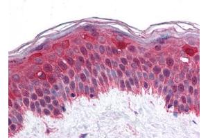 Human Skin: Formalin-Fixed, Paraffin-Embedded (FFPE) (LHX8 抗体)