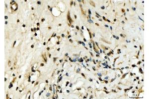 IHC analysis of EXOSC8 using anti-EXOSC8 antibody (ABIN7601850).