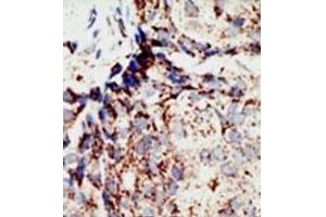 Image no. 1 for anti-BRCA1 Associated Protein-1 (Ubiquitin Carboxy-terminal Hydrolase) (BAP1) (N-Term) antibody (ABIN357594)