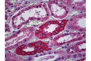 Immunohistochemistry (IHC) image for anti-Calcium Channel, Voltage-Dependent, alpha 2/delta Subunit 2 (CACNA2D2) (AA 65-163) antibody (ABIN790471)